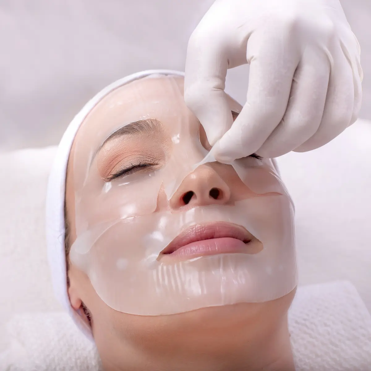 Chemical Peels