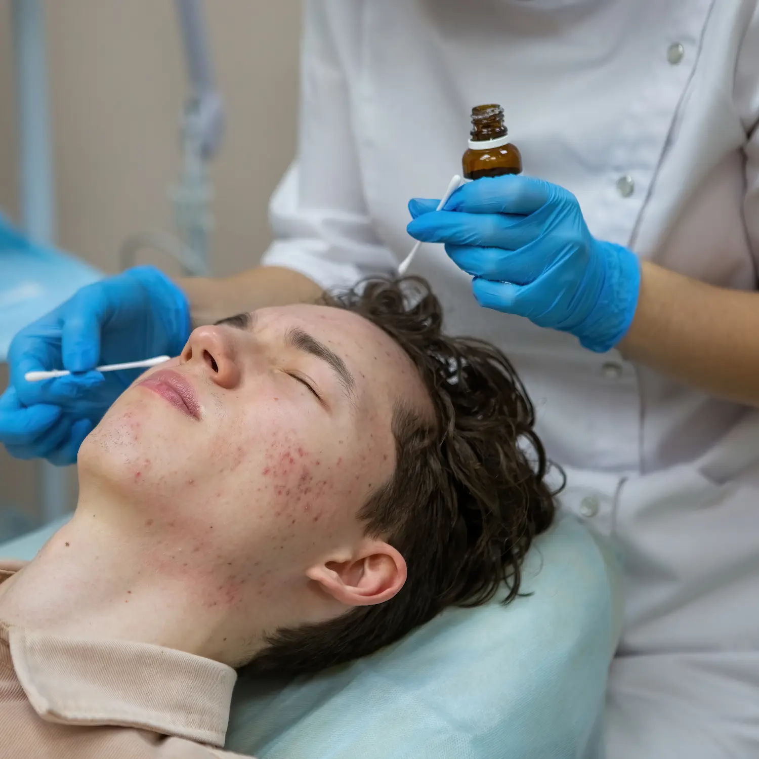 Acne Treatment Facial